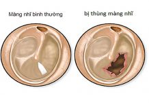 Tỷ lệ phần trăm tổn thương cơ thể do tổn thương tai – mũi – họng – răng – hàm – mặt